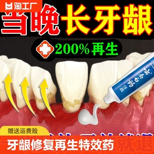 云南白药牙膏牙龈萎缩牙周炎治疗 药牙齿松动专用